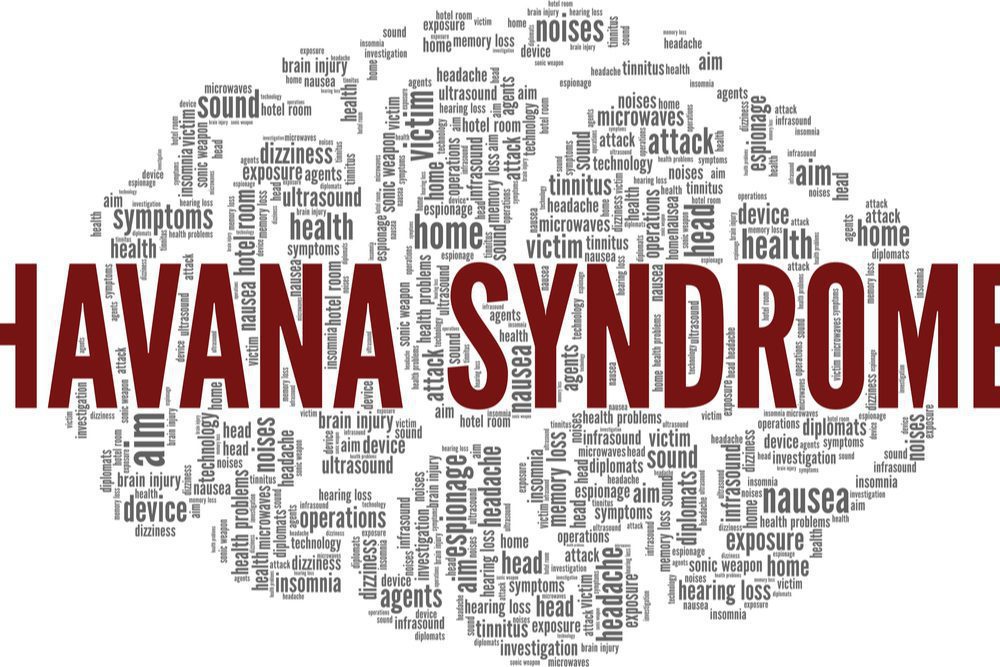 Is Havana Syndrome An Act of War by Cuba? 1 Havana Syndrome