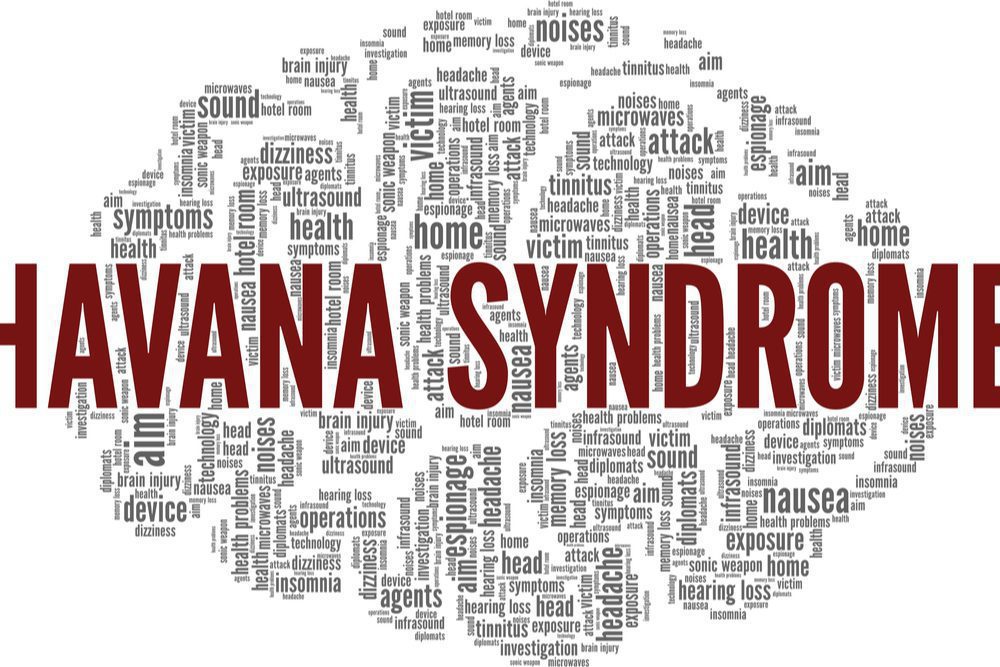 Havana Syndrome